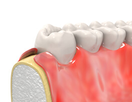 Periodontia